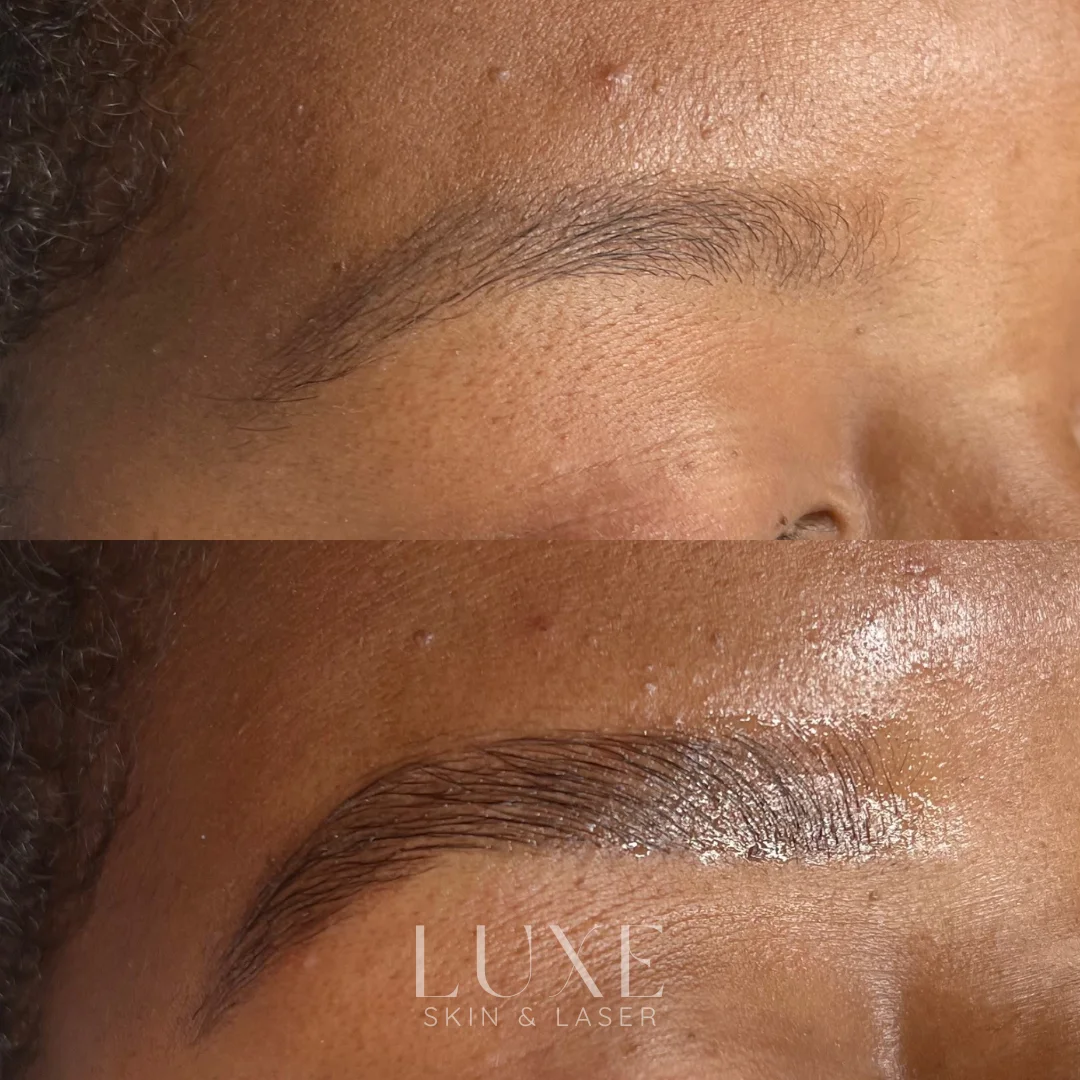 Luxe.zip-19 Eyebrow lamination before and after — Luxe Skin & Laser