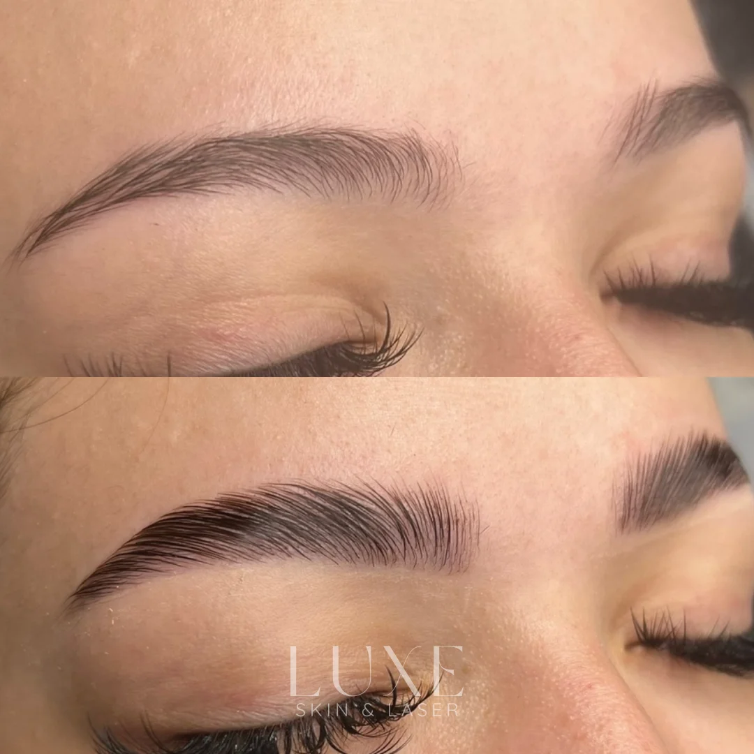 Luxe.zip-9 Eyebrow lamination results (before and after) — Luxe Skin & Laser